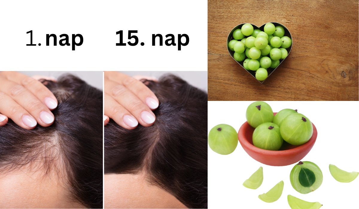 A hajhullás megállítása: csupán 2 összetevőre lesz szükséged hozzá